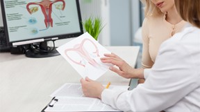 Tratamiento de los pólipos endometriales