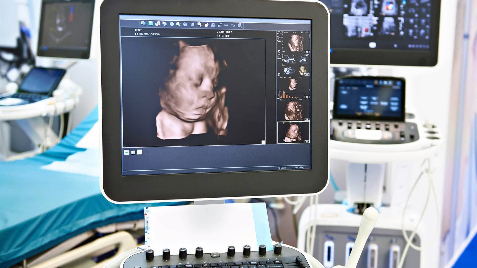 Realizamos ecografía 3D y 4D de tu embarazo