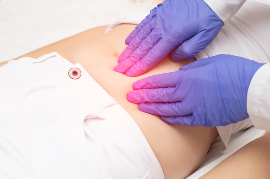¿Qué es la endometriosis?