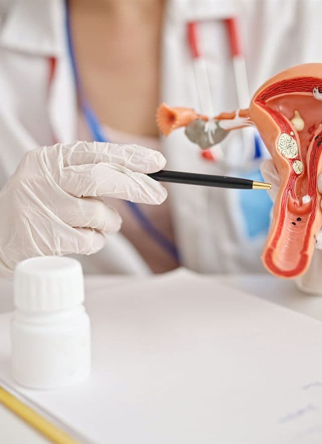 Detén los síntomas de la endometriosis y mejora tu calidad de vida
