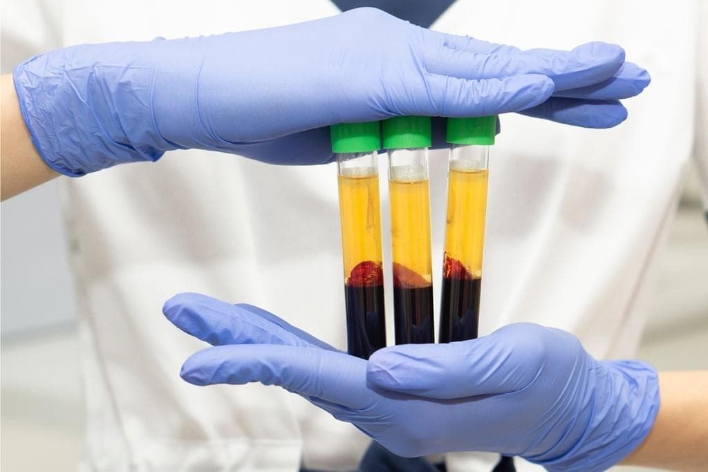Plasma rico en plaquetas para el liquen escleroso vulvar