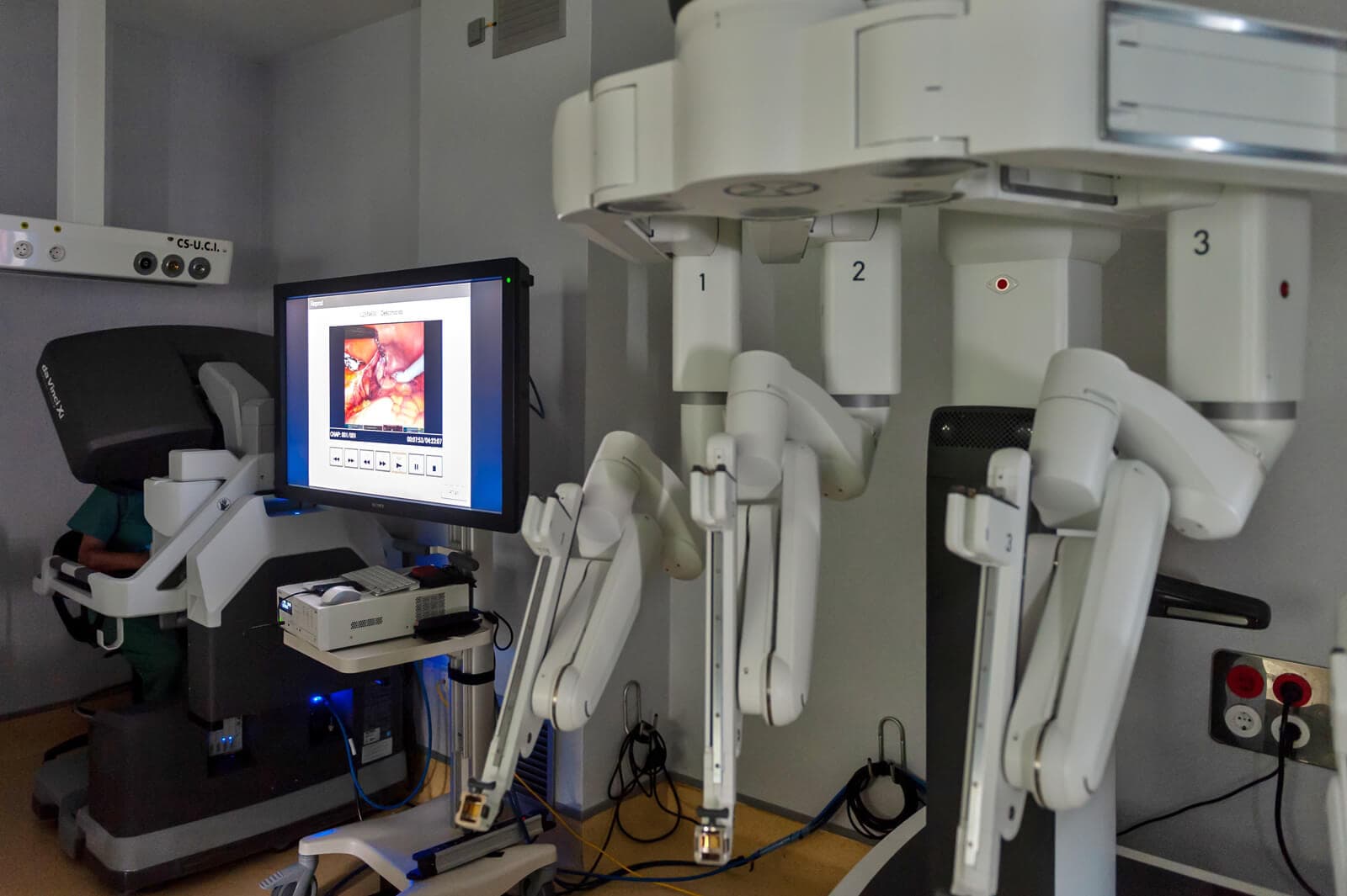Cirugía robotica en Centro gineológico Lúa