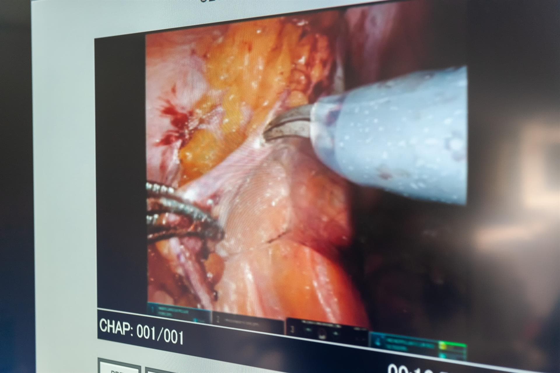 Cirugía robotica en Centro gineológico Lúa