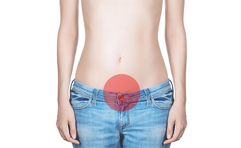 Los miomas uterinos afectan al 70% de las mujeres