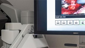 Todo lo que necesita saber sobre la cirugía robótica en ginecología