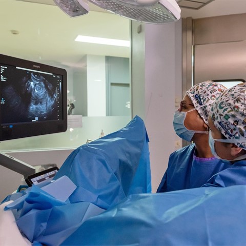 Tratamiento de miomas por radiofrecuencia